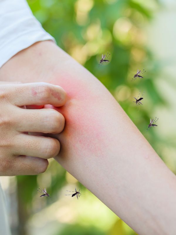 Kammerjäger in Düsseldorf - Schädlingsbekämpfung - Schädlinge bekämpfen